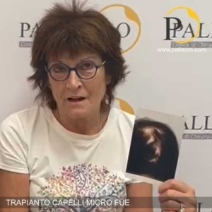 trapianto capelli donna post ustione