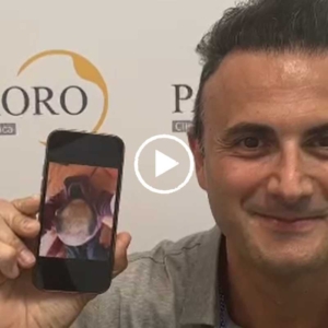 trapianto capelli paziente sorridente
